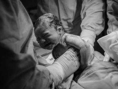 Normal Delivery Care in Noida